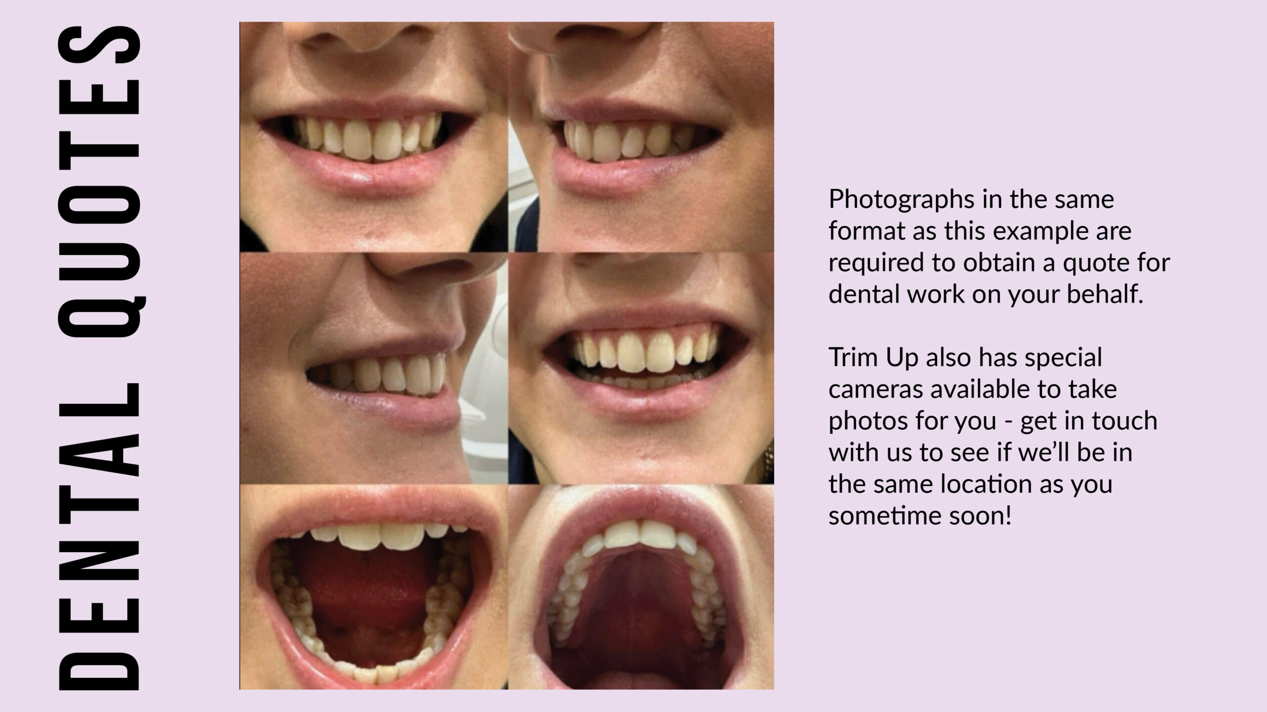 Dental photos Example dental photos for dental quotes
